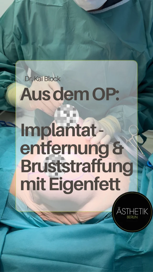 Zurück zur Natürlichkeit.
 Wenn Implantate raus sollen, heißt das nicht: weniger Form.
 Mit Eigenfett und Bruststraffung schaffe ich ein harmonisches, weiches Ergebnis – ganz ohne Silikon.💫

#DrBlockImOP #Explantation #Bruststraffung #Eigenfettbehandlung #NatürlicheBrust #Implantatentfernung #ÄsthetischeChirurgie
